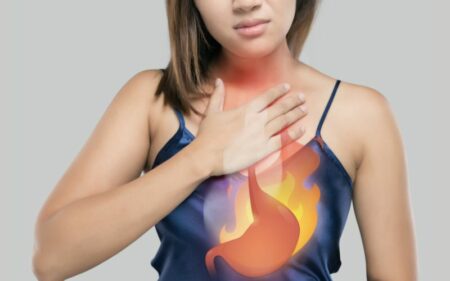 Natural Herbal Treatment To Cure Acidity and Heartburn